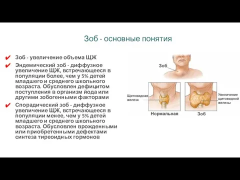 Зоб - основные понятия Зоб - увеличение объема ЩЖ Эндемический зоб