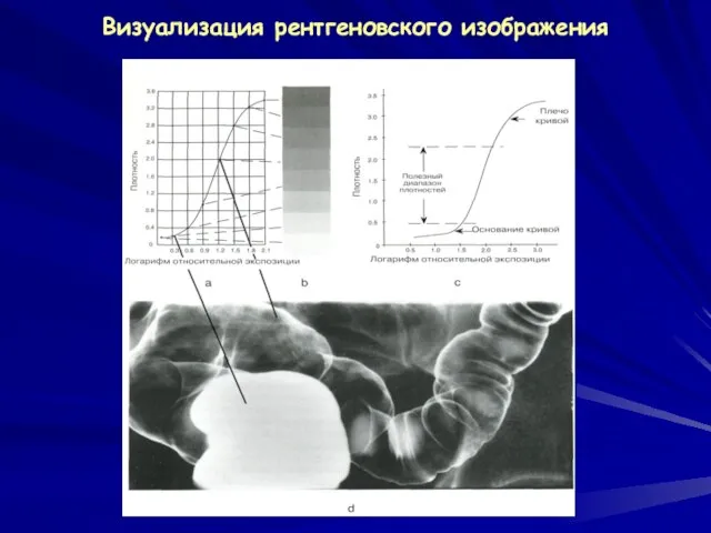 Визуализация рентгеновского изображения