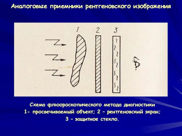 Аналоговые приемники рентгеновского изображения Схема флюороскопического метода диагностики 1- просвечиваемый объект;