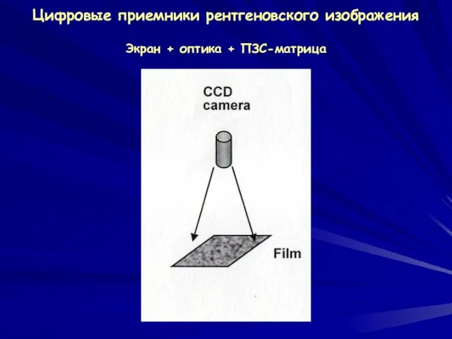Цифровые приемники рентгеновского изображения Экран + оптика + ПЗС-матрица