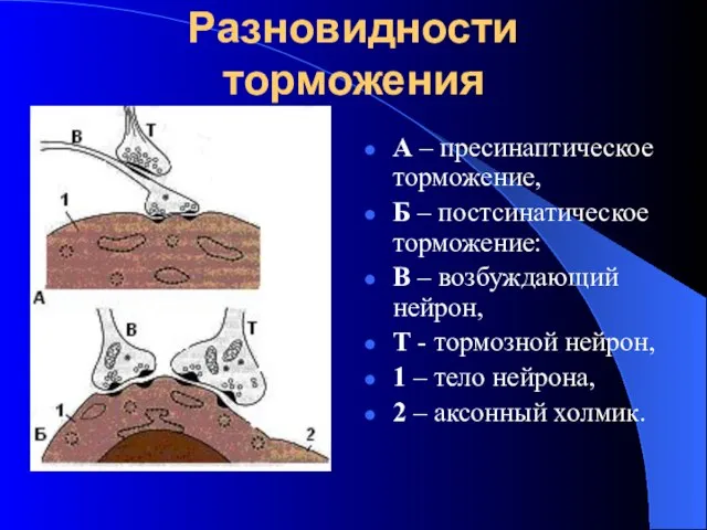 Разновидности торможения А – пресинаптическое торможение, Б – постсинатическое торможение: В