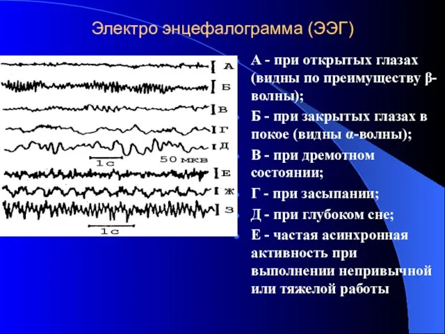 Электро энцефалограмма (ЭЭГ) А - при открытых глазах (видны по преимуществу