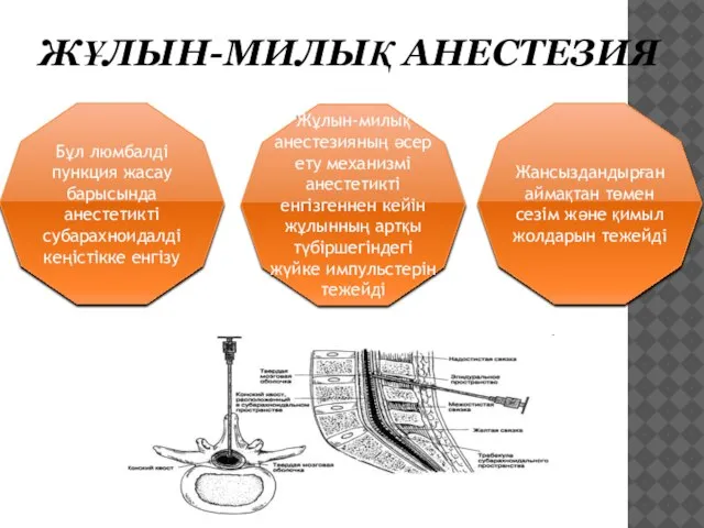 ЖҰЛЫН-МИЛЫҚ АНЕСТЕЗИЯ Бұл люмбалді пункция жасау барысында анестетикті субарахноидалді кеңістікке енгізу