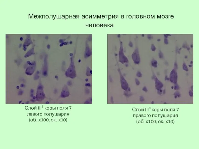 Слой III3 коры поля 7 левого полушария (об. х100, ок. х10)