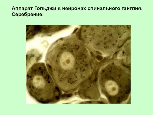 Аппарат Гольджи в нейронах спинального ганглия. Серебрение.