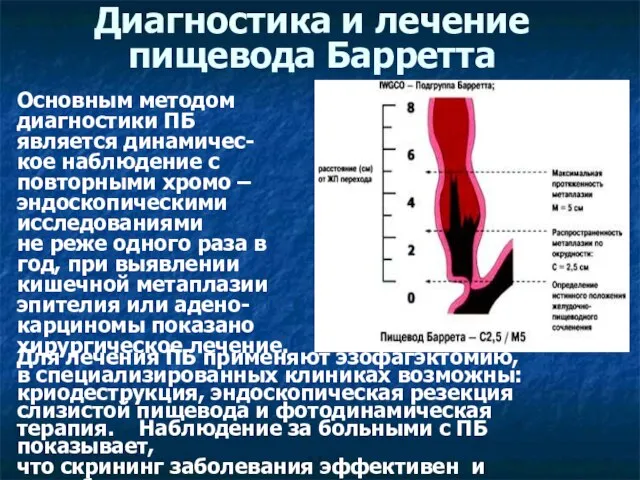 Диагностика и лечение пищевода Барретта Основным методом диагностики ПБ является динамичес-