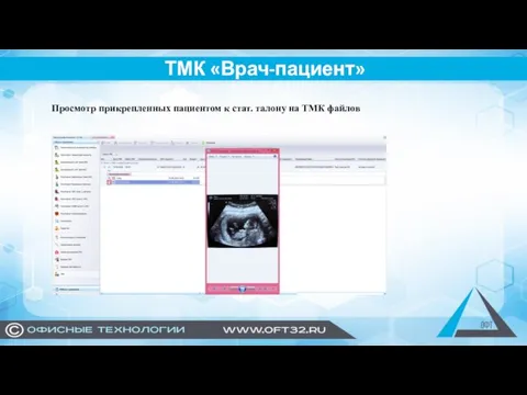 ТМК «Врач-пациент» Просмотр прикрепленных пациентом к стат. талону на ТМК файлов