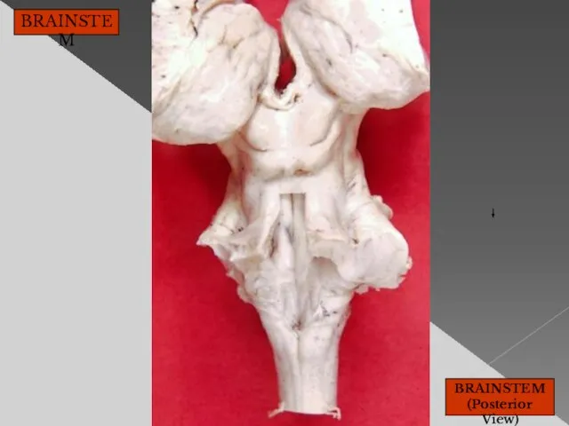 BRAINSTEM BRAINSTEM (Posterior View)