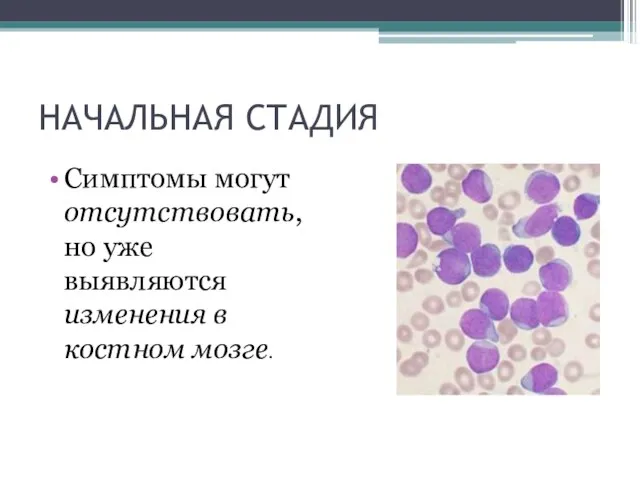 НАЧАЛЬНАЯ СТАДИЯ Симптомы могут отсутствовать, но уже выявляются изменения в костном мозге.