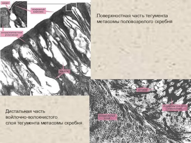 Поверхностная часть тегумента метасомы половозрелого скребня Дистальная часть войлочно-волокнистого слоя тегумента метасомы скребня.