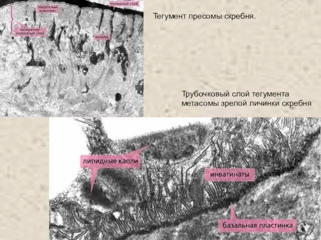 Тегумент пресомы скребня. Трубочковый слой тегумента метасомы зрелой личинки скребня