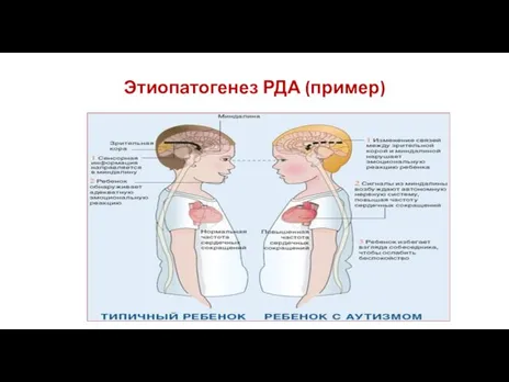 Этиопатогенез РДА (пример)