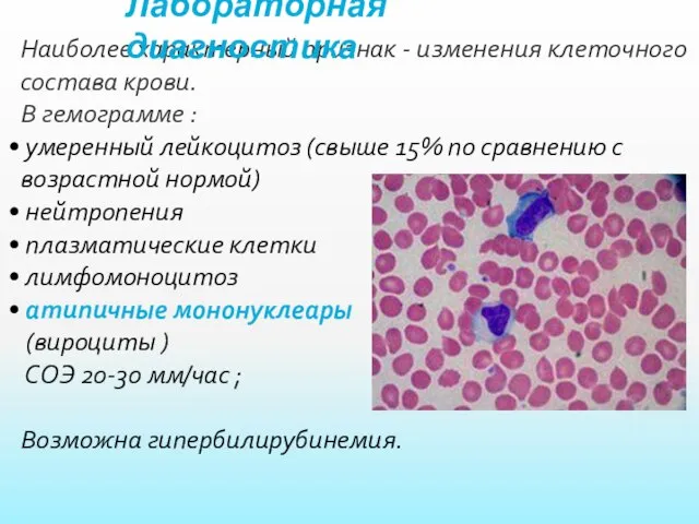 Наиболее характерный признак - изменения клеточного состава крови. В гемограмме :