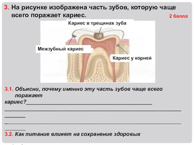 3. На рисунке изображена часть зубов, которую чаще всего поражает кариес.