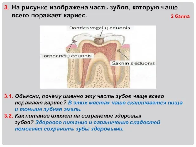 3. На рисунке изображена часть зубов, которую чаще всего поражает кариес.