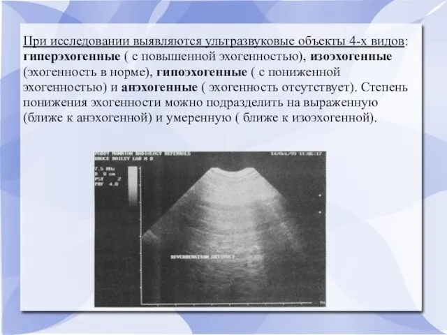 При исследовании выявляются ультразвуковые объекты 4-х видов: гиперэхогенные ( с повышенной