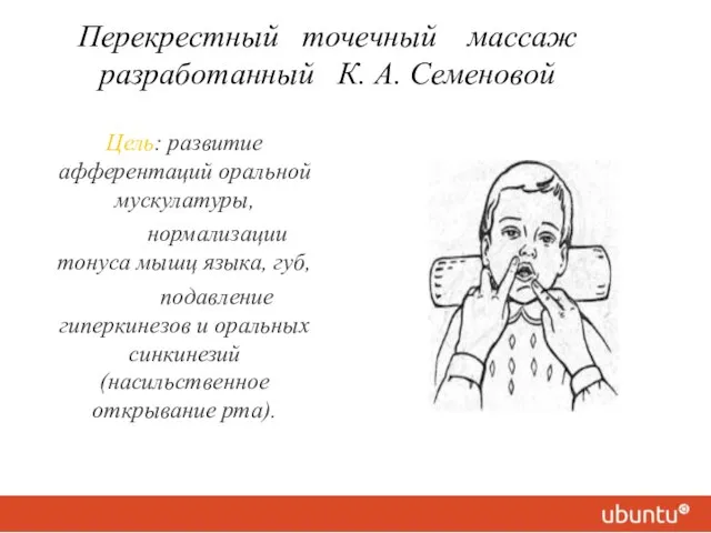 Перекрестный точечный массаж разработанный К. А. Семеновой Цель: развитие афферентаций оральной