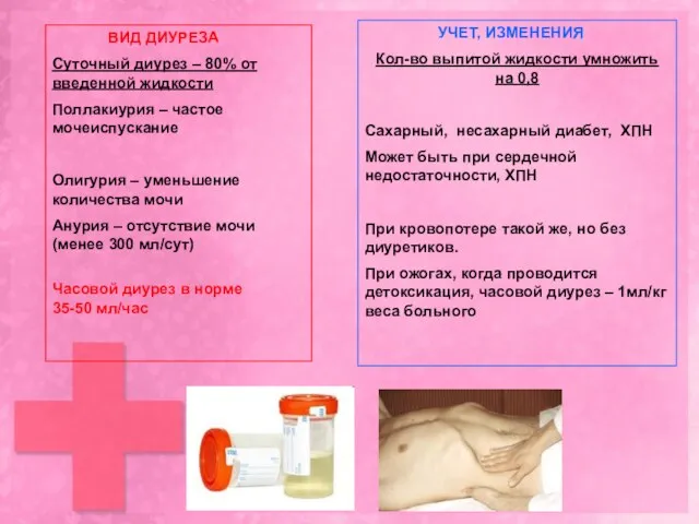 ВИД ДИУРЕЗА Суточный диурез – 80% от введенной жидкости Поллакиурия –