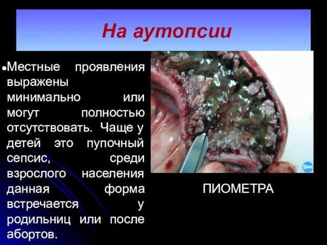 На аутопсии Местные проявления выражены минимально или могут полностью отсутствовать. Чаще