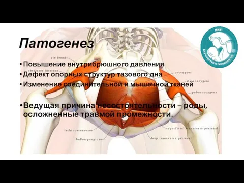 Патогенез Повышение внутрибрюшного давления Дефект опорных структур тазового дна Изменение соединительной