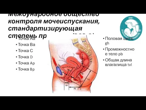 Международное общество контроля мочеиспускания, стандартизирующая степень пролапса (POP-Q) Точка Аа Точка