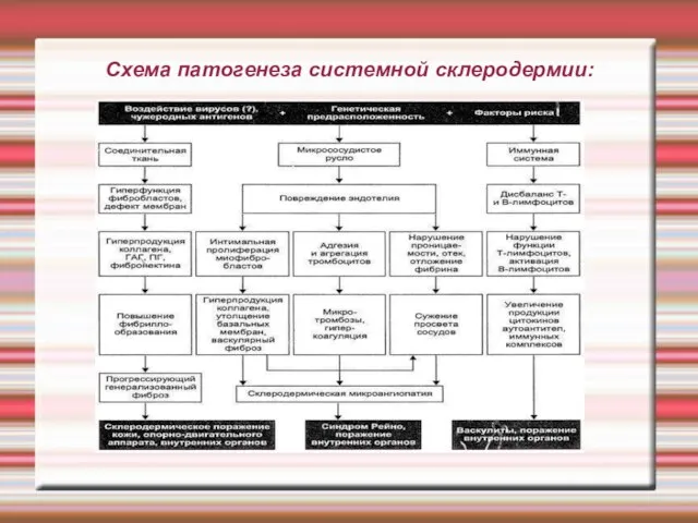 Схема патогенеза системной склеродермии: