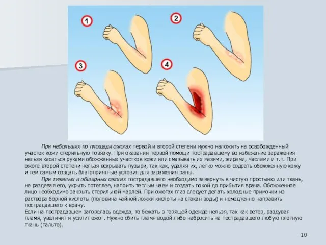 При небольших по площади ожогах первой и второй степени нужно наложить