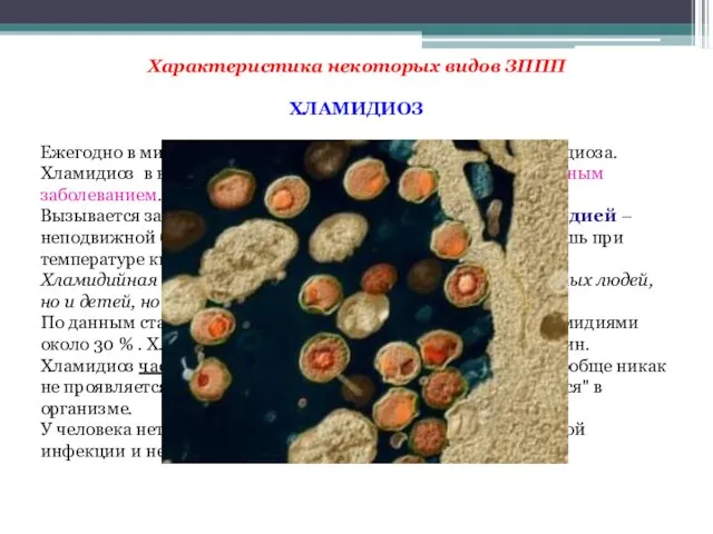 Характеристика некоторых видов ЗППП ХЛАМИДИОЗ Ежегодно в мире регистрируется 89 млн.