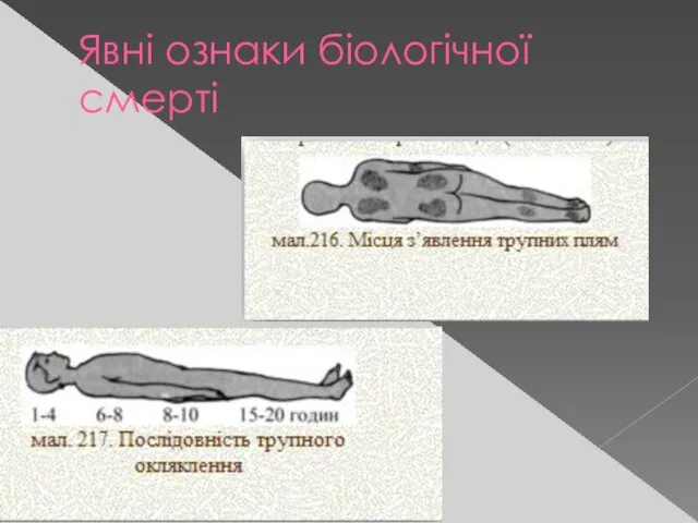 Явні ознаки біологічної смерті