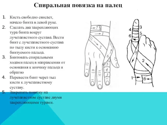 Спиральная повязка на палец Кисть свободно свисает, начало бинта в левой