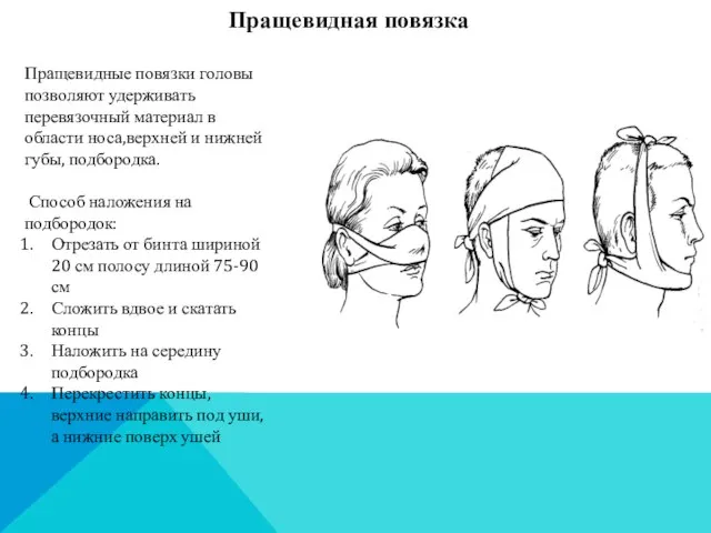 Пращевидные повязки головы позволяют удерживать перевязочный материал в области носа,верхней и