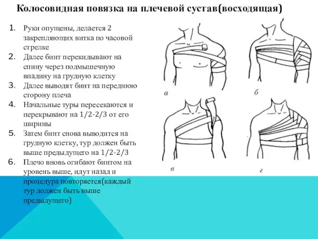 Колосовидная повязка на плечевой сустав(восходящая) Руки опущены, делается 2 закрепляющих витка