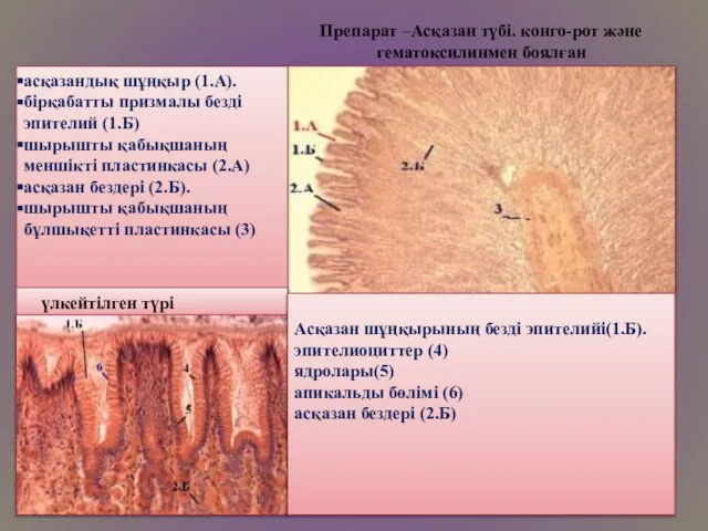 Препарат –Асқазан түбі. конго-рот және гематоксилинмен боялған