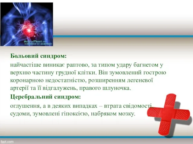 Больовий синдром: найчастіше виникає раптово, за типом удару багнетом у верхню