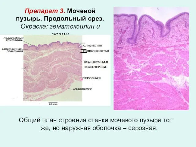 Препарат 3. Мочевой пузырь. Продольный срез. Окраска: гематоксилин и эозин Общий