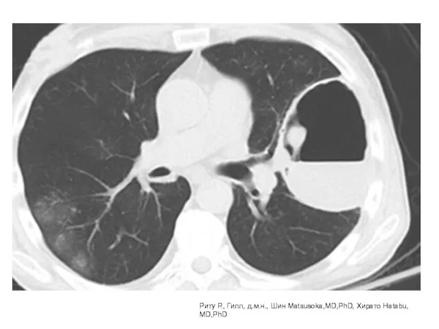 Риту Р., Гилл, д.м.н., Шин Matsusoka,MD,PhD, Хирато Hatabu, MD,PhD Риту Р.,