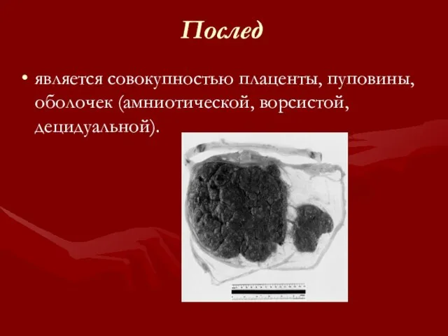 Послед является совокупностью плаценты, пуповины, оболочек (амниотической, ворсистой, децидуальной).