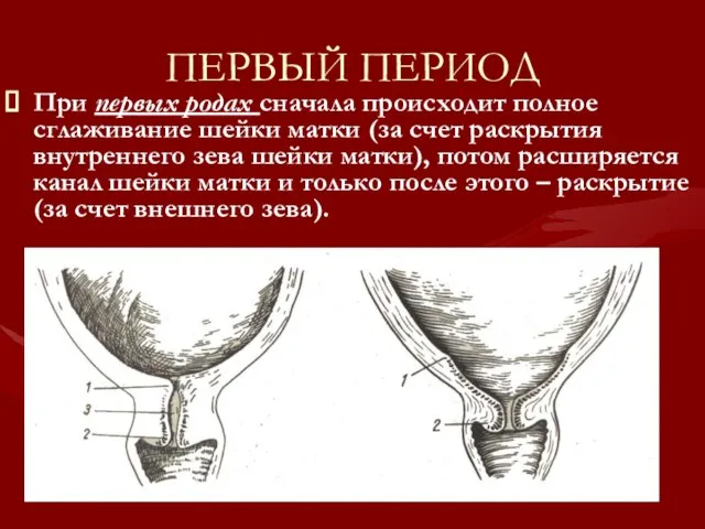 ПЕРВЫЙ ПЕРИОД При первых родах сначала происходит полное сглаживание шейки матки