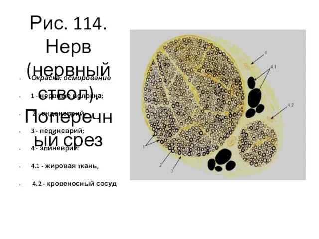 Рис. 114. Нерв (нервный ствол). Поперечный срез Окраска: осмирование 1 -