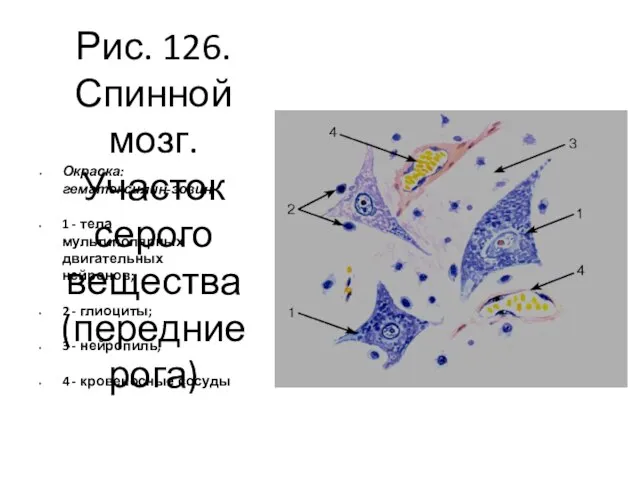 Рис. 126. Спинной мозг. Участок серого вещества (передние рога) Окраска: гематоксилин-эозин