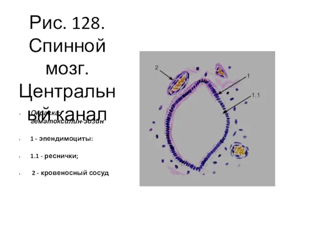 Рис. 128. Спинной мозг. Центральный канал Окраска: гематоксилин-эозин 1 - эпендимоциты: