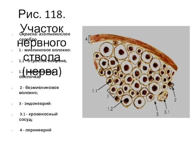 Рис. 118. Участок нервного ствола (нерва) Окраска: азотнокислое серебро 1 -