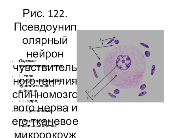 Рис. 122. Псевдоуниполярный нейрон чувствительного ганглия спинномозгового нерва и его тканевое