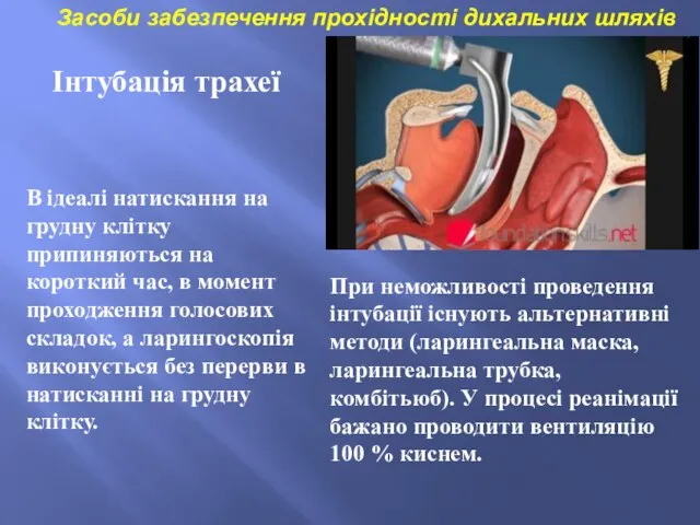 Засоби забезпечення прохідності дихальних шляхів При неможливості проведення інтубації існують альтернативні