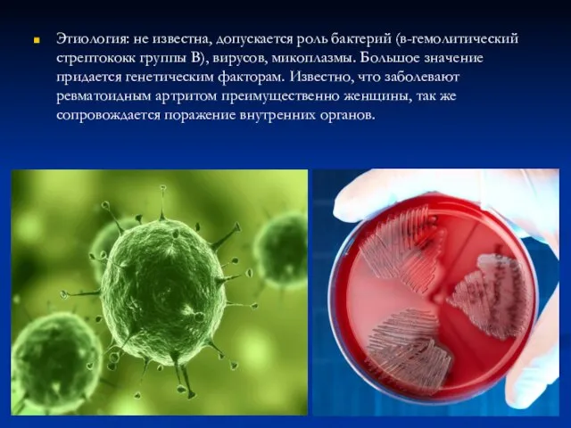 Этиология: не известна, допускается роль бактерий (в-гемолитический стрептококк группы В), вирусов,