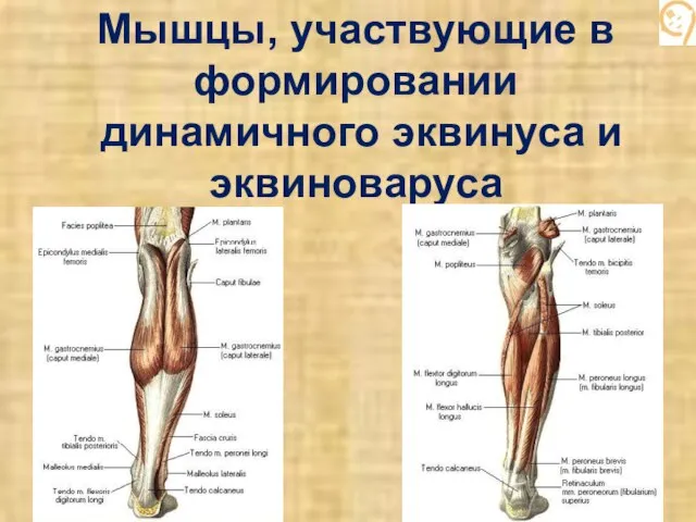 Мышцы, участвующие в формировании динамичного эквинуса и эквиноваруса