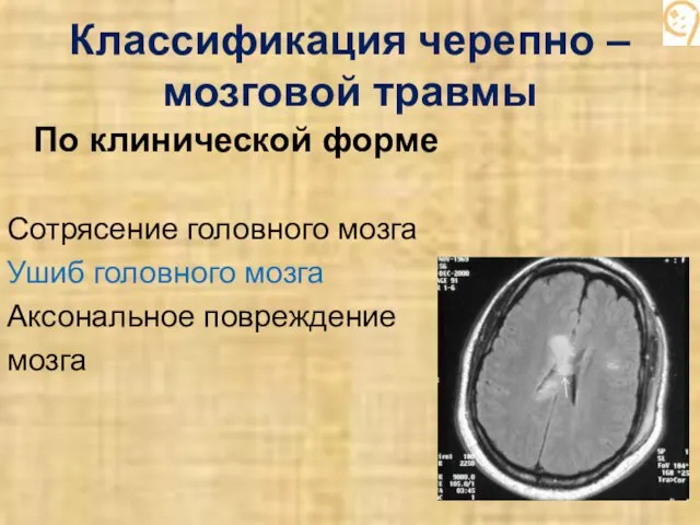 Классификация черепно – мозговой травмы По клинической форме Сотрясение головного мозга