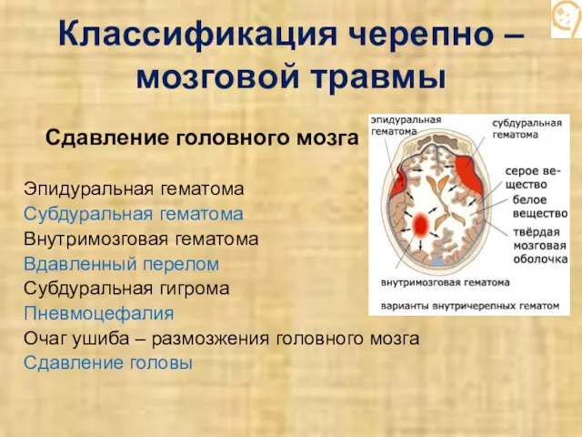 Классификация черепно – мозговой травмы Сдавление головного мозга Эпидуральная гематома Субдуральная