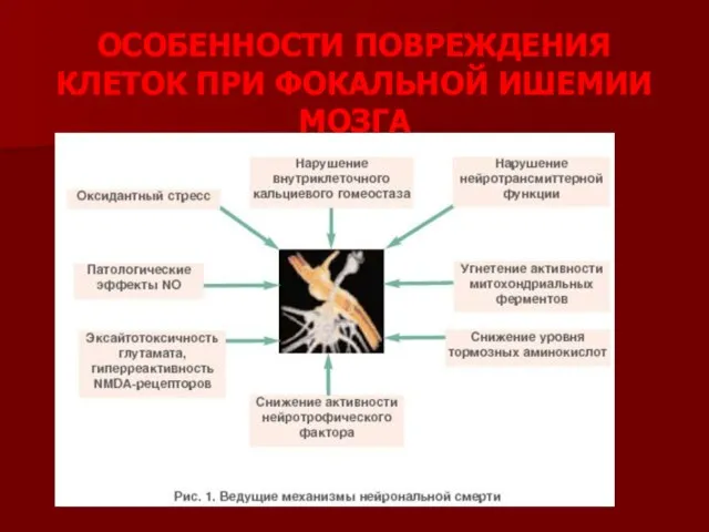 ОСОБЕННОСТИ ПОВРЕЖДЕНИЯ КЛЕТОК ПРИ ФОКАЛЬНОЙ ИШЕМИИ МОЗГА