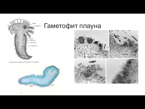 Гаметофит плауна